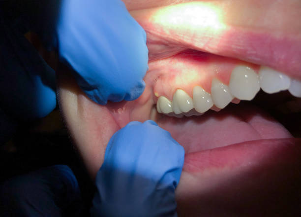 Best Emergency Dentist for Knocked-Out Tooth in , TX
